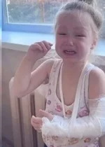 Воспитательница в детском саду Серова вывихнула руку трехлетней девочке.webp