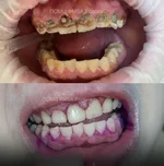 Из-за энергетиков россиянин едва не остался без зубов.webp