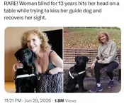Женщина, которая 13 лет была слепой, ударилась головой об угол столика, пытаясь приласкать со...webp